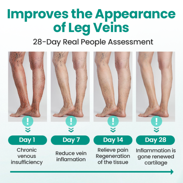 LAOZIK® LegRenew Varicose Veins Patch